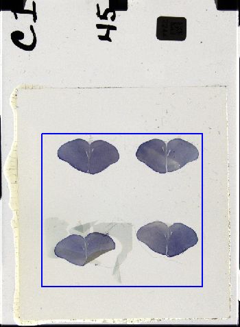 Media type: image; Special Collections 3298   shows specimen_part histological serial section;